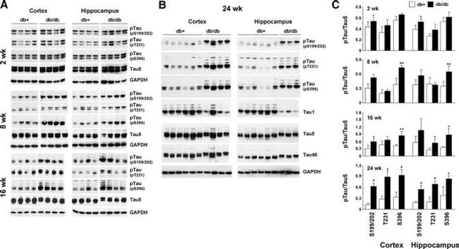 Phospho-Tau (Ser396) Antibody in Western Blot (WB)