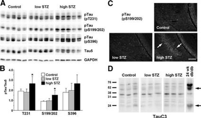 Phospho-Tau (Ser396) Antibody in Western Blot (WB)