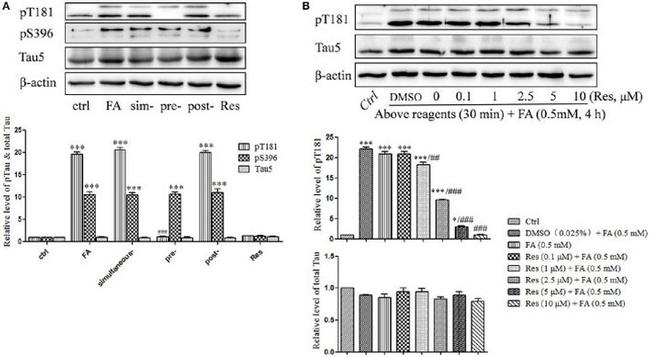 Phospho-Tau (Ser396) Antibody in Western Blot (WB)