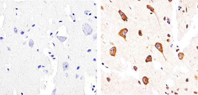 Phospho-Tau (Ser404) Antibody in Immunohistochemistry (Paraffin) (IHC (P))