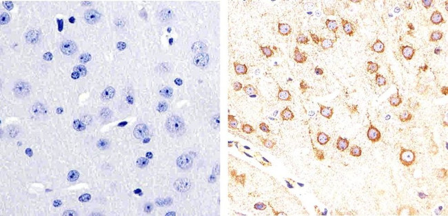 Phospho-Tau (Ser404) Antibody in Immunohistochemistry (Paraffin) (IHC (P))