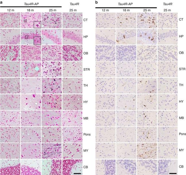 Phospho-Tau (Ser422) Antibody in Immunohistochemistry (Paraffin) (IHC (P))