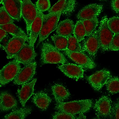 Moesin Antibody in Immunocytochemistry (ICC/IF)