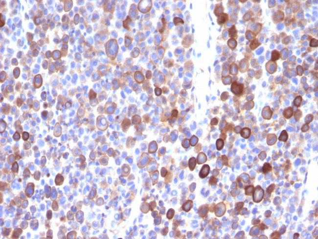 Moesin Antibody in Immunohistochemistry (Paraffin) (IHC (P))