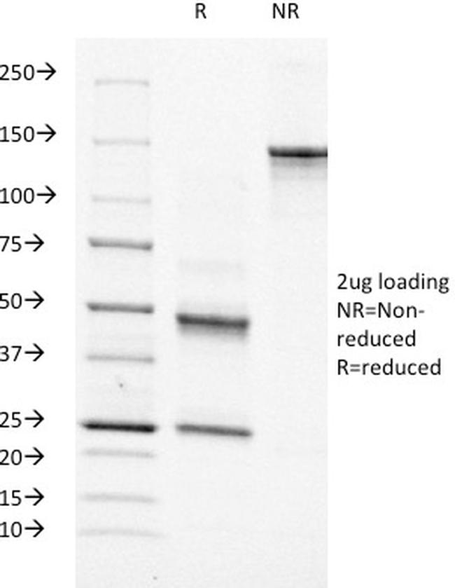 Moesin Antibody in SDS-PAGE (SDS-PAGE)