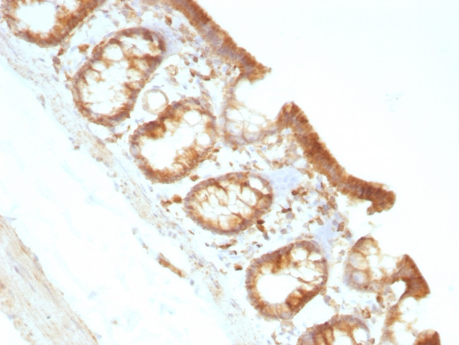 Moesin Antibody in Immunohistochemistry (Paraffin) (IHC (P))