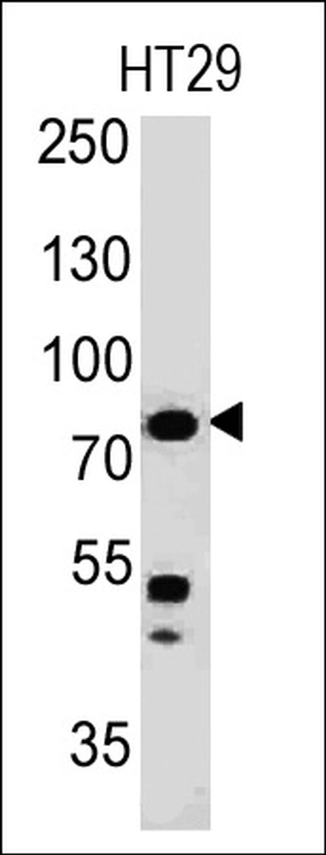 Moesin Antibody in Western Blot (WB)