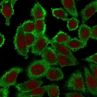 Moesin Antibody in Immunocytochemistry (ICC/IF)