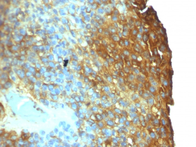 Moesin Antibody in Immunohistochemistry (Paraffin) (IHC (P))