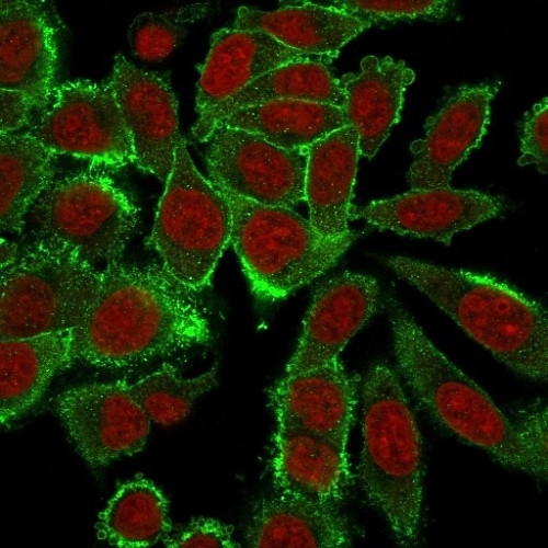 Moesin Antibody in Immunocytochemistry (ICC/IF)