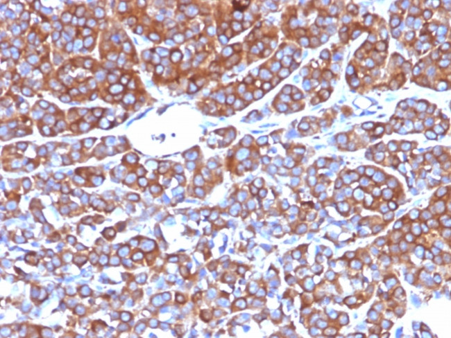 Moesin Antibody in Immunohistochemistry (Paraffin) (IHC (P))