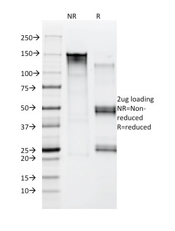 Moesin Antibody in SDS-PAGE (SDS-PAGE)