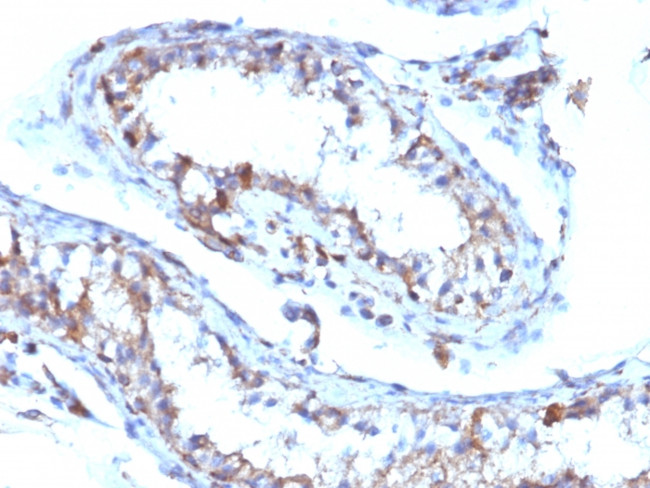 Moesin Antibody in Immunohistochemistry (Paraffin) (IHC (P))