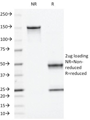 Moesin Antibody in SDS-PAGE (SDS-PAGE)