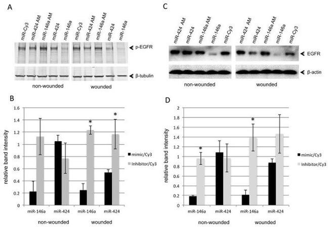 Phospho-EGFR (Tyr845) Antibody in Western Blot (WB)