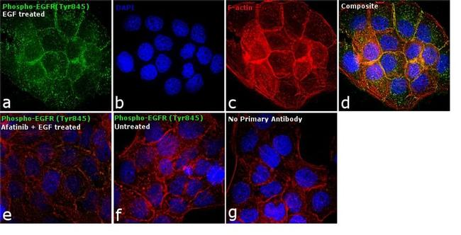 Phospho-EGFR (Tyr845) Antibody