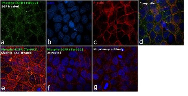 Phospho-EGFR (Tyr992) Antibody