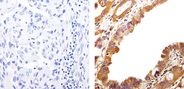 Phospho-EGFR (Tyr992) Antibody in Immunohistochemistry (Paraffin) (IHC (P))