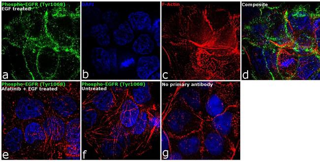 Phospho-EGFR (Tyr1068) Antibody