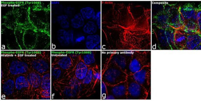 Phospho-EGFR (Tyr1068) Antibody in Immunocytochemistry (ICC/IF)