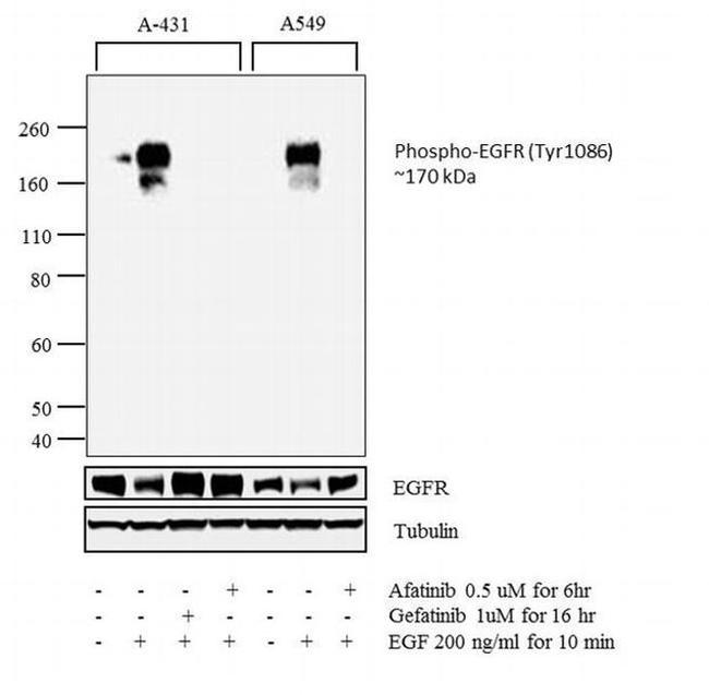 Phospho-EGFR (Tyr1086) Antibody in Western Blot (WB)