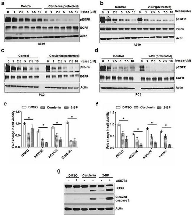 Phospho-EGFR (Tyr1173) Antibody in Western Blot (WB)