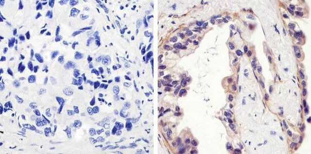 Phospho-EGFR (Tyr1173) Antibody in Immunohistochemistry (Paraffin) (IHC (P))