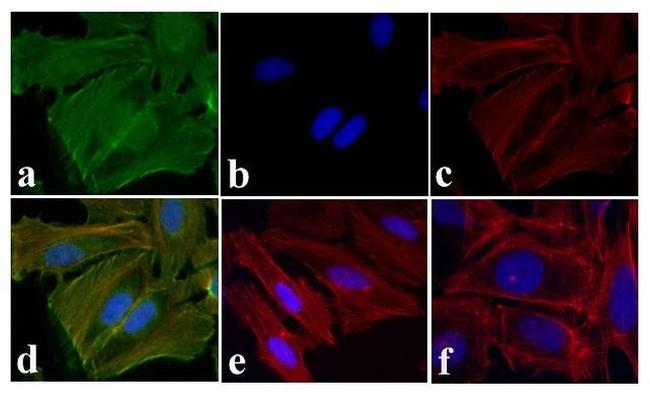 Phospho-EGFR (Tyr1173) Antibody