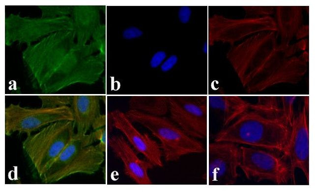 Phospho-EGFR (Tyr1173) Antibody in Immunocytochemistry (ICC/IF)