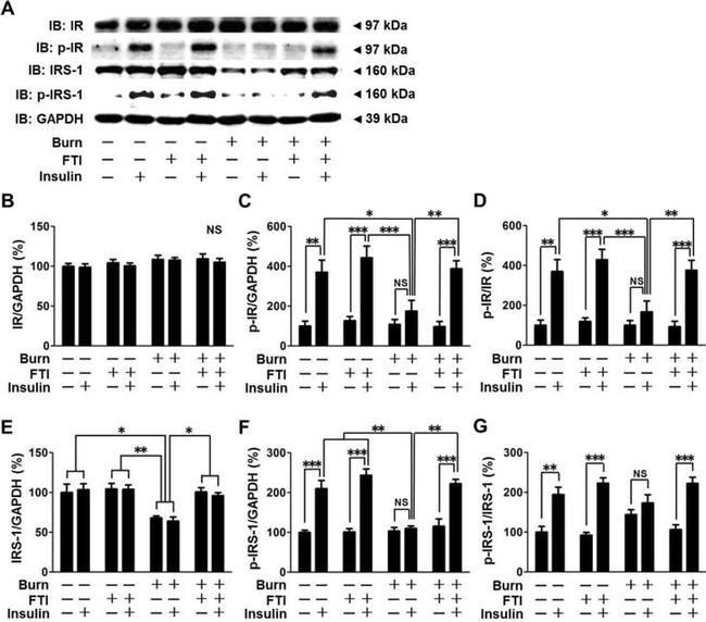 Phospho-IRS1 (Tyr612) Antibody in Western Blot (WB)