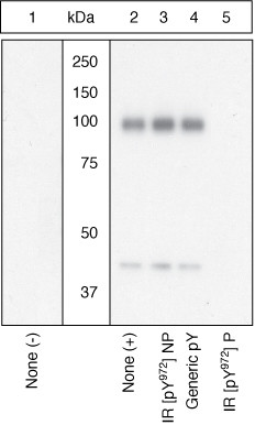 Phospho-INSR (Tyr972) Antibody in Western Blot (WB)