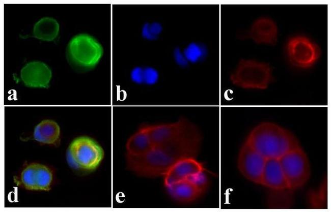 Phospho-INSR (Tyr972) Antibody