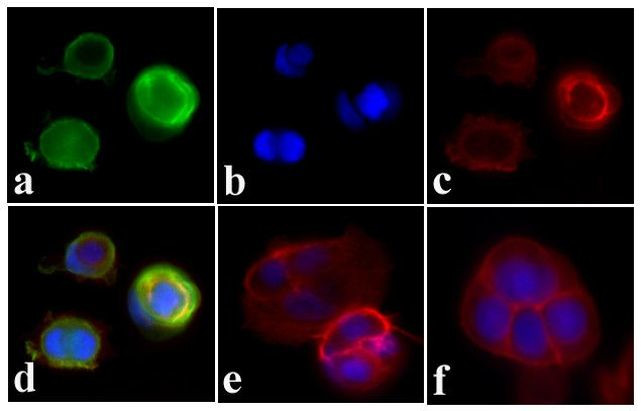 Phospho-INSR (Tyr972) Antibody in Immunocytochemistry (ICC/IF)