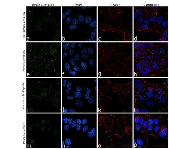 Phospho-IR/IGF1R (Tyr1158) Antibody in Immunocytochemistry (ICC/IF)