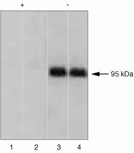 Phospho-IR/IGF1R (Tyr1158) Antibody in Western Blot (WB)