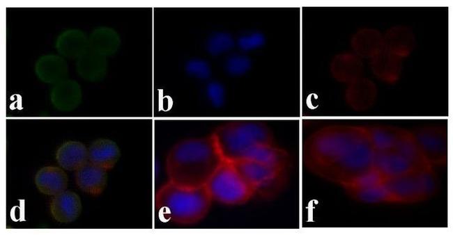 Phospho-IR/IGF1R (Tyr1158) Antibody