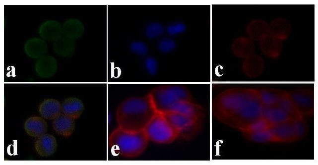 Phospho-IR/IGF1R (Tyr1158) Antibody in Immunocytochemistry (ICC/IF)