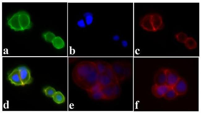 Phospho-IR/IGF1R (Tyr1162, Tyr1163) Antibody