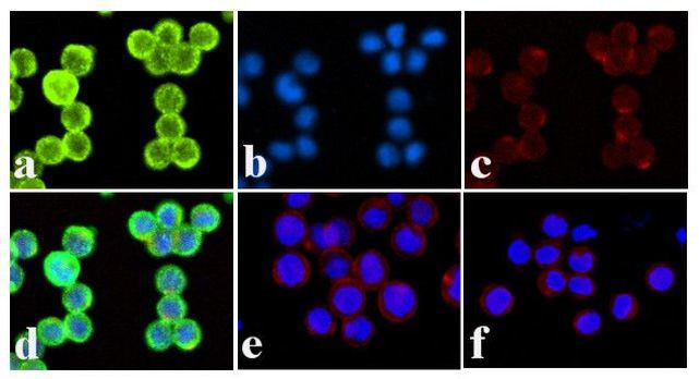 Phospho-INSR (Tyr1328) Antibody in Immunocytochemistry (ICC/IF)