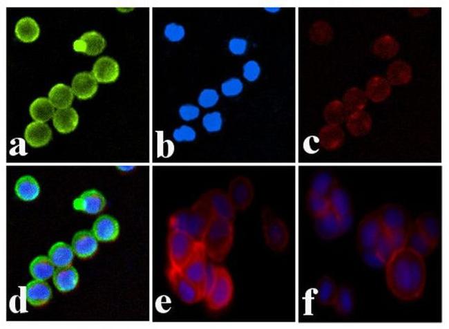 Phospho-INSR (Tyr1334) Antibody