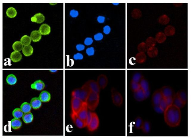 Phospho-INSR (Tyr1334) Antibody in Immunocytochemistry (ICC/IF)