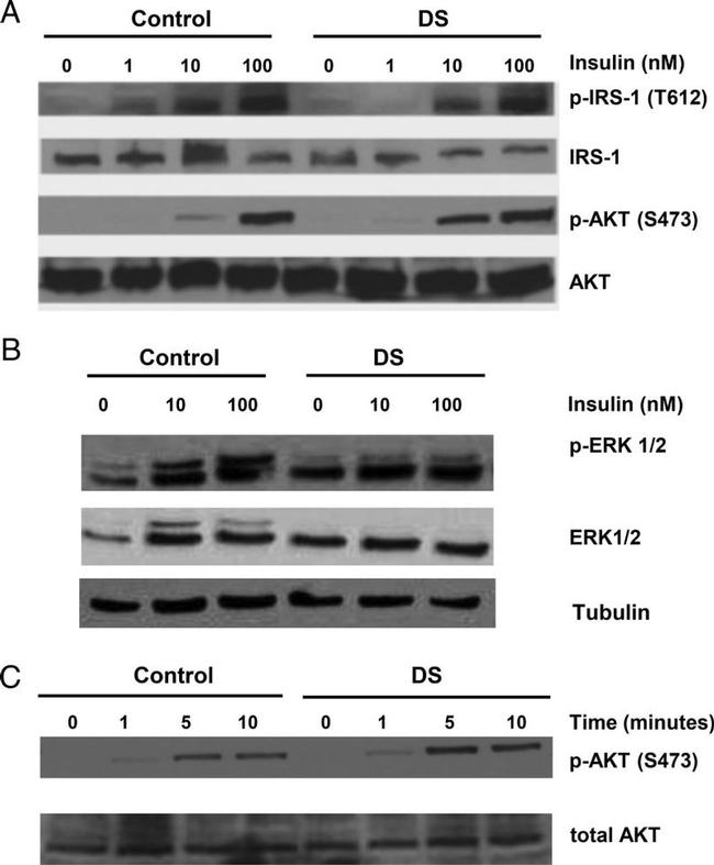 Phospho-IRS1 (Tyr612) Antibody in Western Blot (WB)