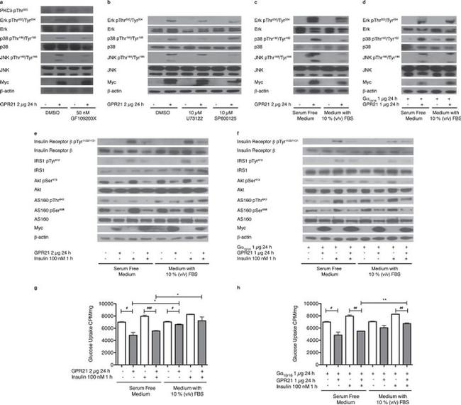 Phospho-IRS1 (Tyr612) Antibody in Western Blot (WB)