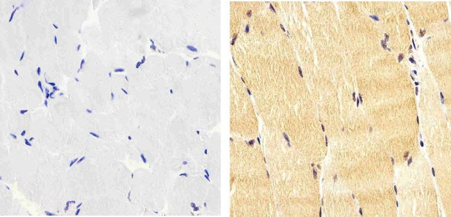 Phospho-IRS1 (Tyr612) Antibody in Immunohistochemistry (Paraffin) (IHC (P))