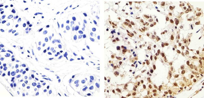 Phospho-IRS1 (Tyr896) Antibody in Immunohistochemistry (Paraffin) (IHC (P))