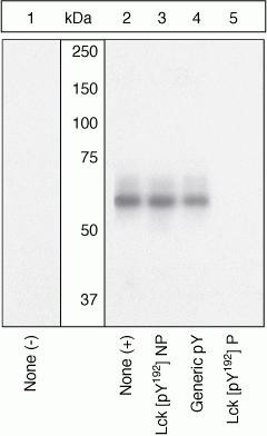 Phospho-LCK (Tyr192) Antibody in Western Blot (WB)