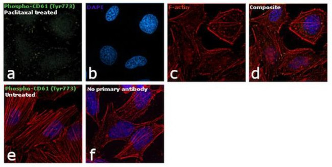 Phospho-CD61 (Tyr773) Antibody in Immunocytochemistry (ICC/IF)