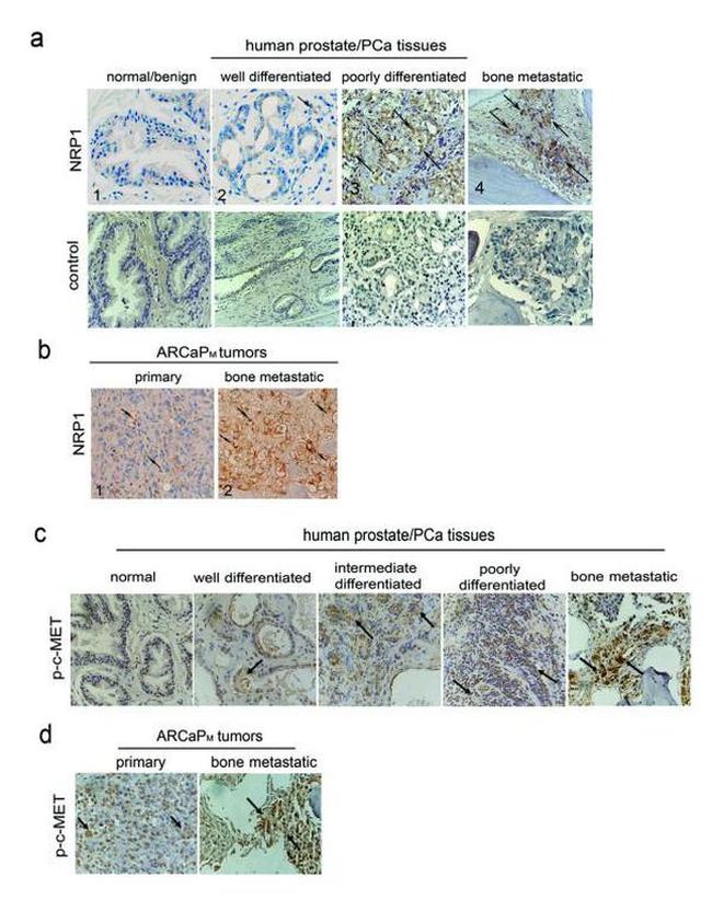 Phospho-c-Met (Tyr1230, Tyr1234, Tyr1235) Antibody in Immunohistochemistry (IHC)