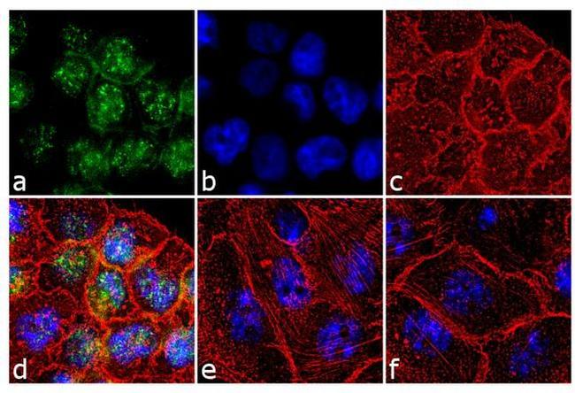 Phospho-p70 S6 Kinase (Thr229) Antibody