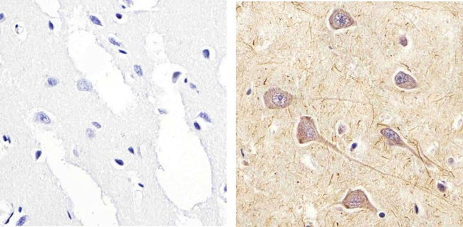 Phospho-RSK1 (Ser221) Antibody in Immunohistochemistry (Paraffin) (IHC (P))